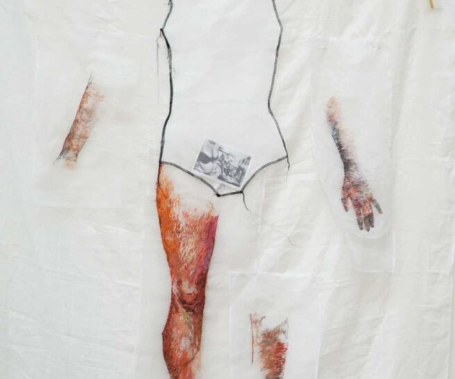 Drawing of a human body with a photograph